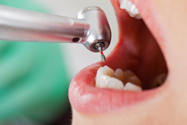 Best Weekend Emergency Dentist in East Gaffney, SC
